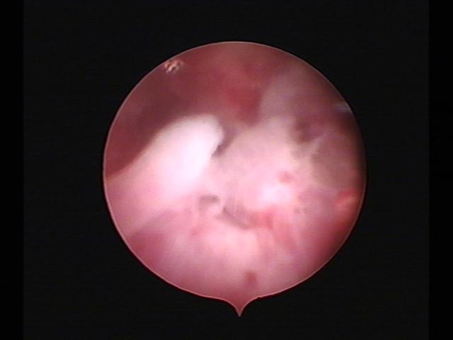 Resectoscopy (2)(11).jpg