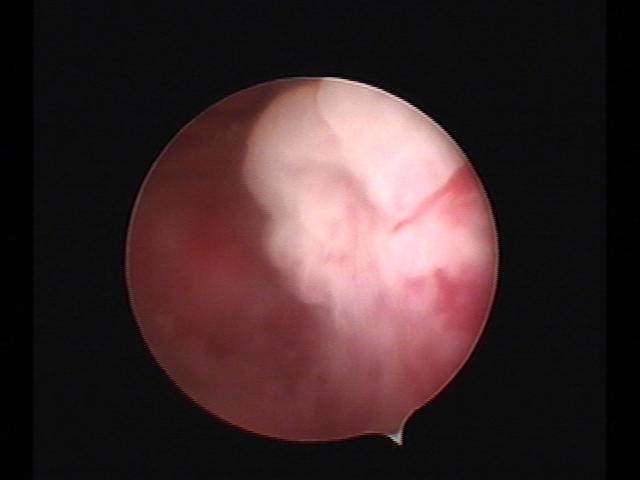 Resectoscopy (2)(12).jpg