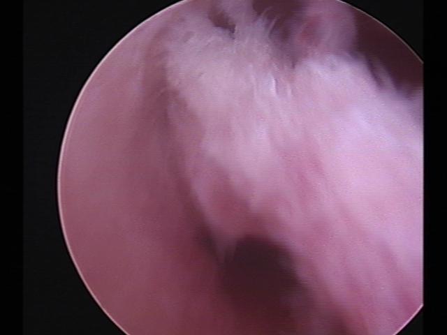 Resectoscopy (2)(18).jpg