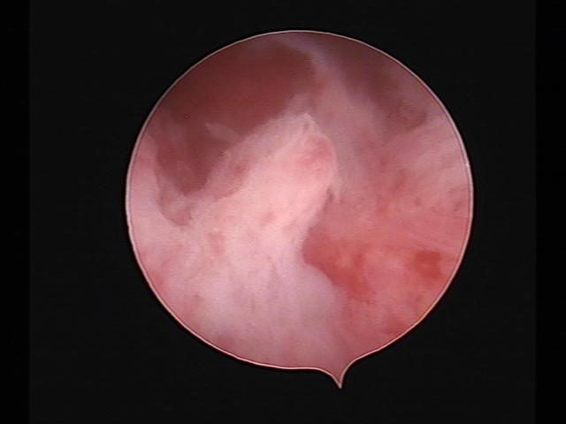 Resectoscopy (2)(34).jpg