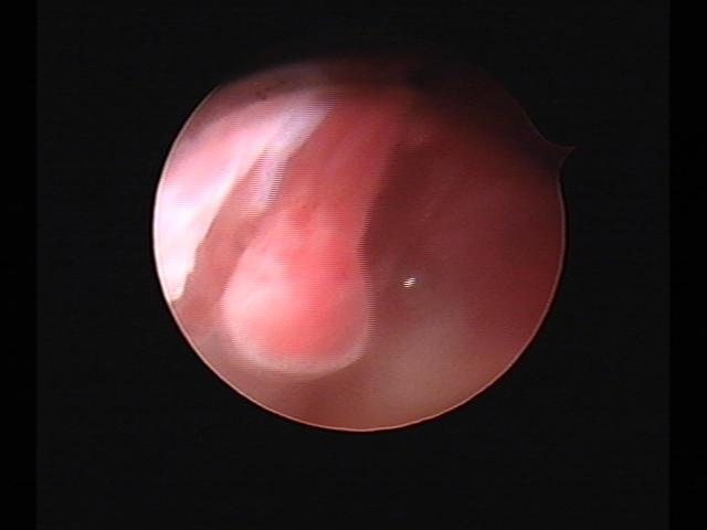 Resectoscopy (2)(36).jpg