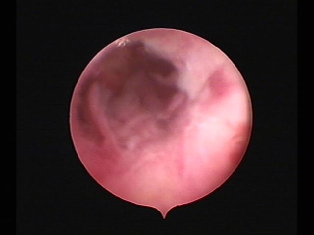 Resectoscopy (3)(11).jpg