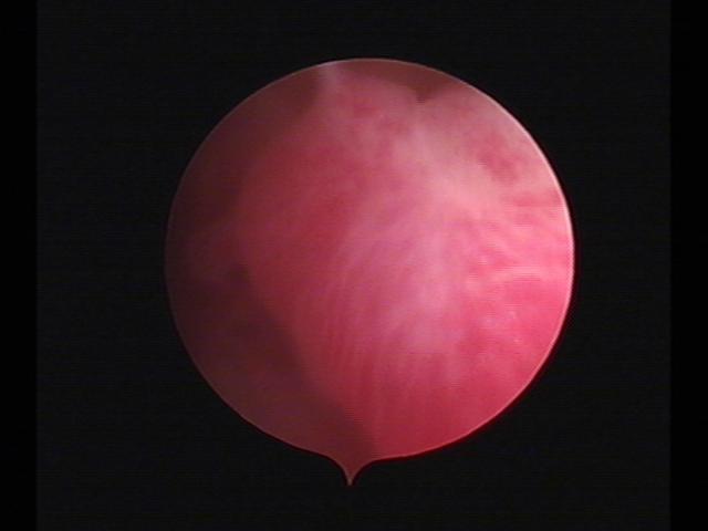 Resectoscopy (3)(19).jpg