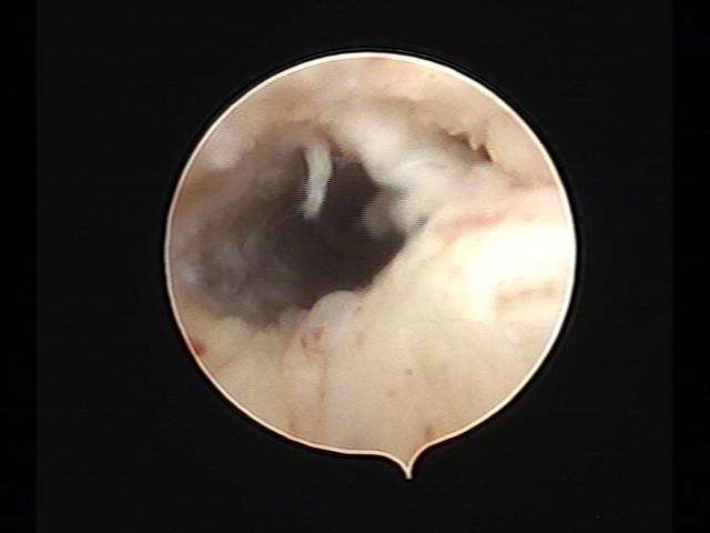 Resectoscopy (3)(23).jpg