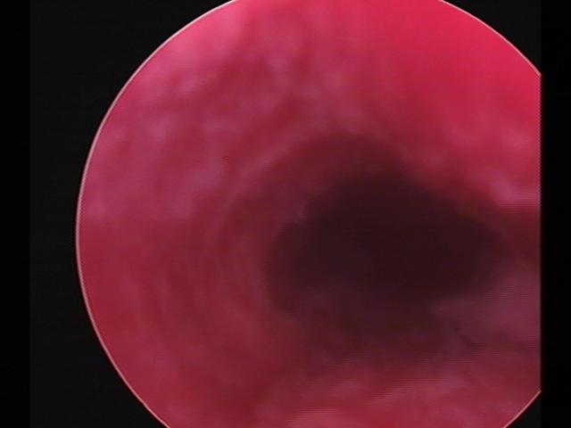 Resectoscopy (4)(14).jpg