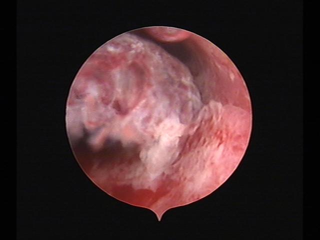 Resectoscopy (4)(20).jpg