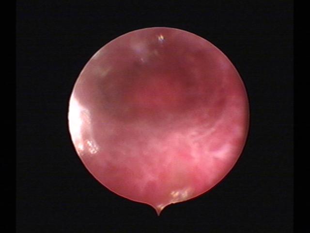 Resectoscopy (6)(2).jpg