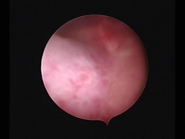 Resectoscopy(13).jpg