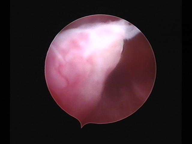 Resectoscopy(20).jpg