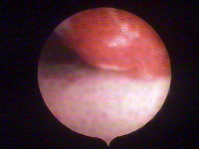 resectoscopy (2)(5).jpg