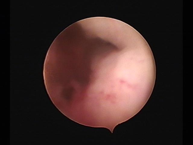 resectoscopy (3)(12).jpg