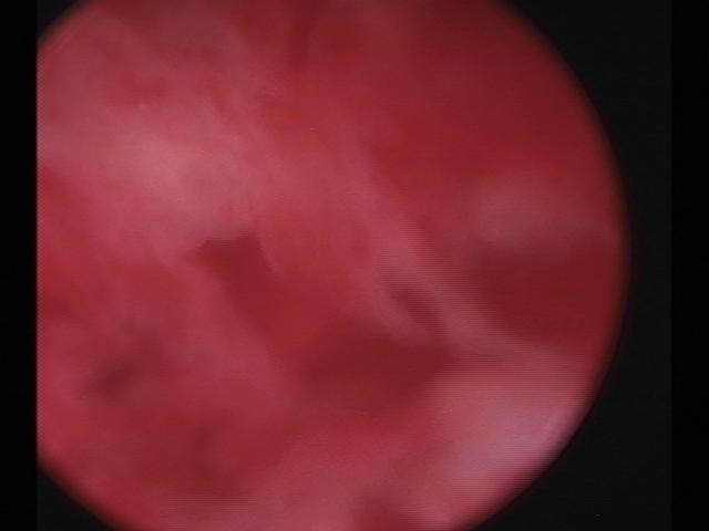 resectoscopy (3)(14).jpg