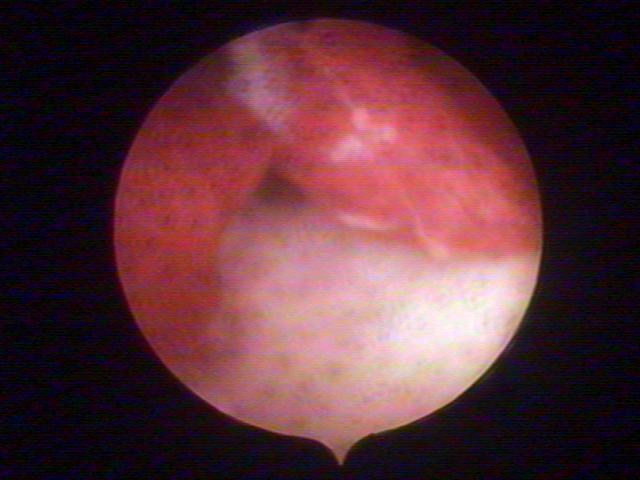 resectoscopy (3)(2).jpg