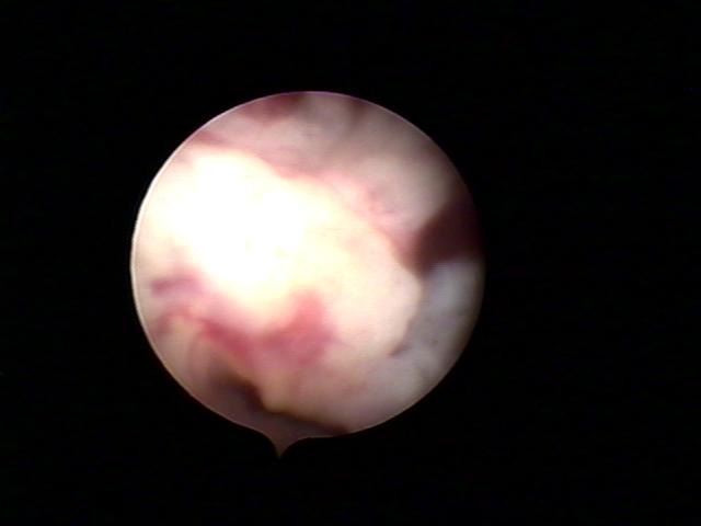 resectoscopy (4)(0).jpg