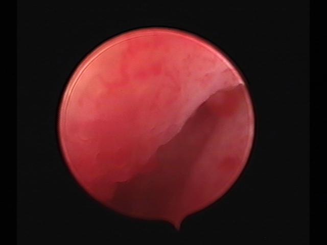 resectoscopy(12).jpg