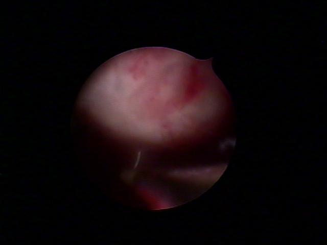 resectoscopy(2).jpg